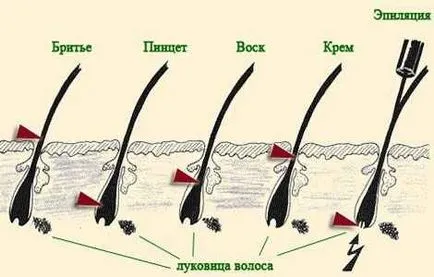 Независимо премахне окосмяването по лицето постоянно у дома