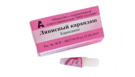 Как да премахнете папилома у дома
