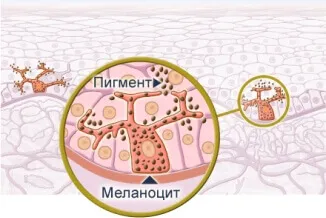 Как да се коригира липсата на меланин в организма