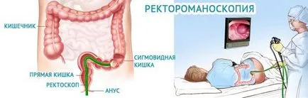 Капсули fitomaksom плюс лечение на папиломи