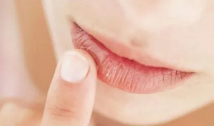Какво сърбеж устните хубав знак за целувка