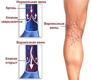 Когато краката болят