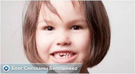 Когато есента млечните зъби при децата и препоръки подробна схема на родителите