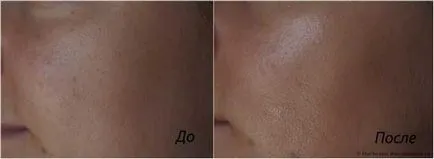 Eye крем Виши idealia и отзиви за него