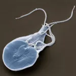 Giardia какво е, снимка и симптоми, лечение, отколкото опасно и обитаван от паразити (лечение) Giardia какво е, снимка и симптоми, лечение, отколкото опасно и когато паразити живеят