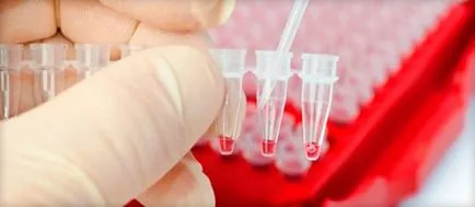 Giardia в детските симптоми и лечение, както е докладвано лямблиоза, какви анализи да предаде списък с лекарства