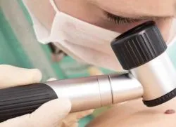 Много мола върху тялото 1
