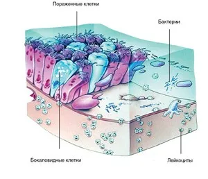 Myrtol три стандартизиран механизъм на действие с риносинуит