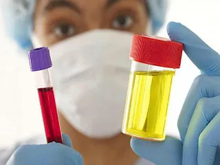 Урина с кръв при жените и това е симптом