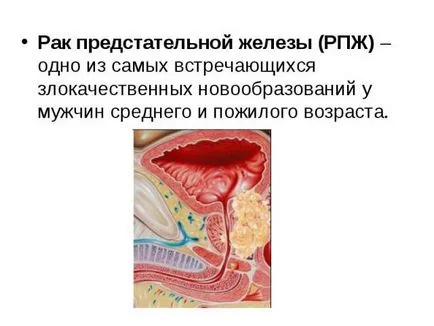 Урина с кръв и болка по време на уриниране при мъжете