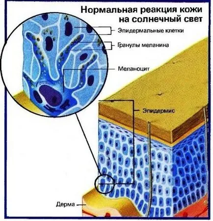 Меланинът, което е - продукти увеличават производството на меланин, помощ и съвети