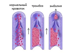 Норм анализ Д-димер от седмица