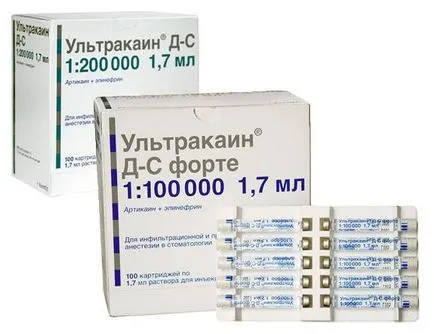 Анестезия (упойка) в методи стоматология и формулировки