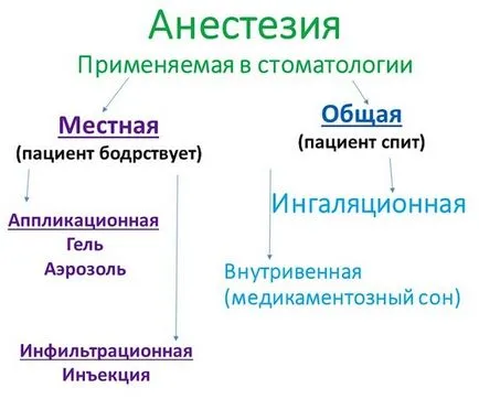 Анестезия в стоматологията - лекарства и класификация (аналгезия) Анестезия в стоматологията - лекарства и класификация