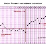 Определяне на пола на ударите на сърцето на детето в продължение на 12 седмици - да се определи какво тоновете на плода,