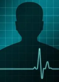 Сърдечна недостатъчност причини и механизъм на клиничния синдром, долекарска помощ и насоки за реанимация