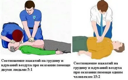 Спиране на сърцето - причини, симптоми и лечение