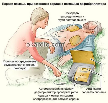 Сърдечна недостатъчност причинява симптомите, оказване на първа помощ и прогноза
