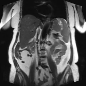 Препарати за MRI (томография) абдоминално