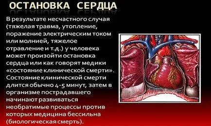 Симптоми и причини за внезапно спиране на сърдечната