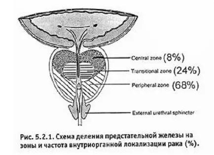 Простатит капитация диагноза