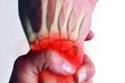 комплексни регионални синдром на болка причини, симптоми, лечение