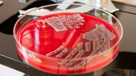 Aureus при деца, така предават и как да хванеш златната възрастни