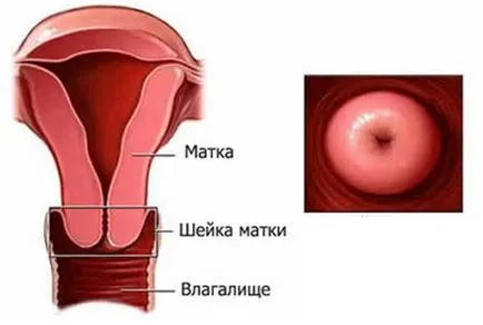 промивка гинекологичен