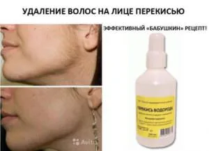 Премахване на окосмяване у дома завинаги - ефективни методи и рецепти, ревюта