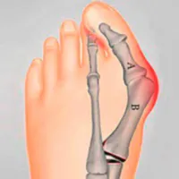 Грижа за кожено яке, отколкото да се лекува у дома Грижа за кожено яке, отколкото да се лекува у дома