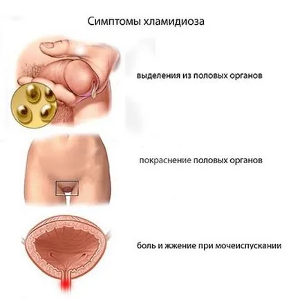 Chlamydia това е, видовете, причини, симптоми, лечение, профилактика