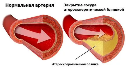 Съдово заболяване на долните крайници причините и симптомите (разбира) Съдово заболяване на долните крайници причините и симптомите