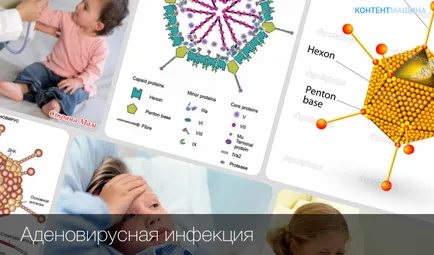 Аденовирус инфекция е