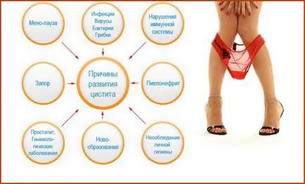 Симптоми като цистит Симптоми като цистит