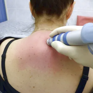 видове Fibrolipoma, причинява тази формация, методи за диагностика и лечение