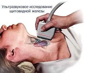 Базедовата болест - каква е тази класификация, симптоми и лечение на (а) Базедовата болест - каква е тази класификация, симптоми и лечение