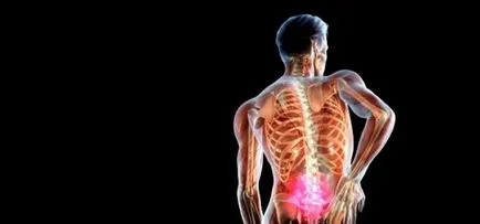 Гръбначните симптоми на херния и лечение, причини и симптоми, снимки