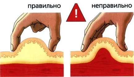 Как да си направим един изстрел в хълбока правилна инжекционна техника с видео