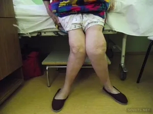 Как за лечение на остеоартрит на коляното в дома лечение на най-различни начини