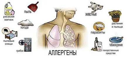 Как да се разграничи алергия от настинка при възрастни и деца, при кърмачета, как да се определи (детето) Как да се разграничи алергия от настинка при възрастни и деца, при кърмачета, как да се идентифицират