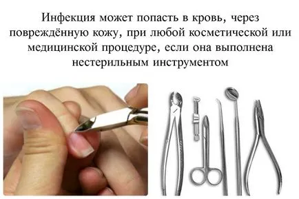 Как да се зарази с ХИВ чрез кръвта могат да бъдат заразени от питейна заразена кръв, колкото е необходимо