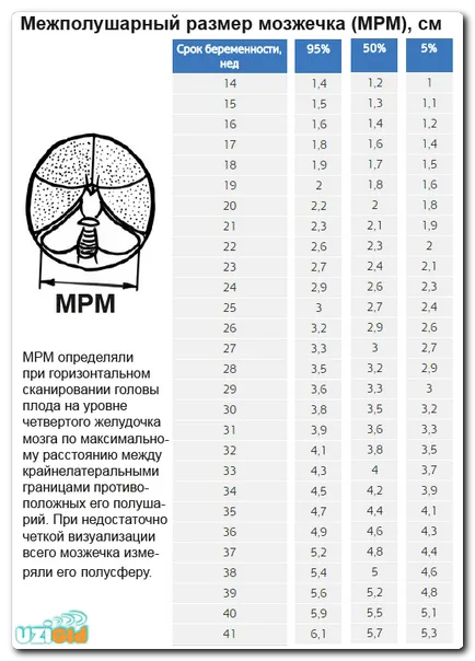 CTE и MRM на ултразвук по време на бременност, маса правила