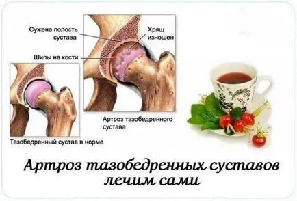 Лечение на хип народни средства