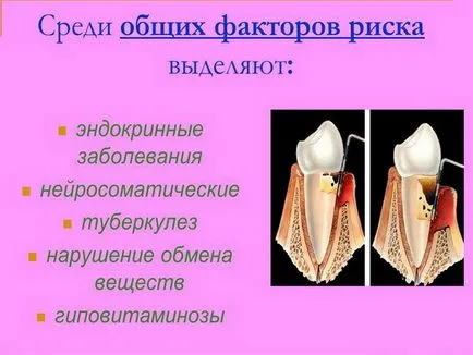 пародонтит лечение на народната медицина най-ефективните начини