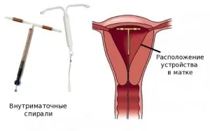 Месечен съсирена