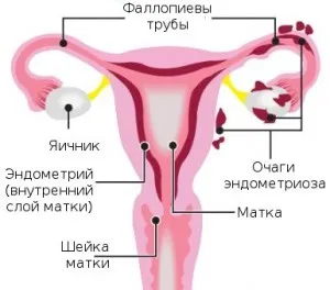 Месечен съсирена
