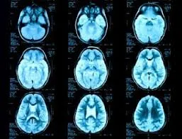 MRI показва, че черният дроб и как да се подготвим
