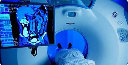 Mri отворени и затворени че по-добрите видове скенери