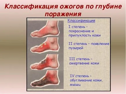 Какво ще се случи, ако пункцията изгори
