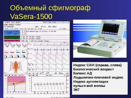 Пулс при деца разполага и пулс изпълнение в зависимост от възрастта (таблица) (сърце) Пулс при деца разполага и пулс изпълнение в зависимост от възрастта (таблица)